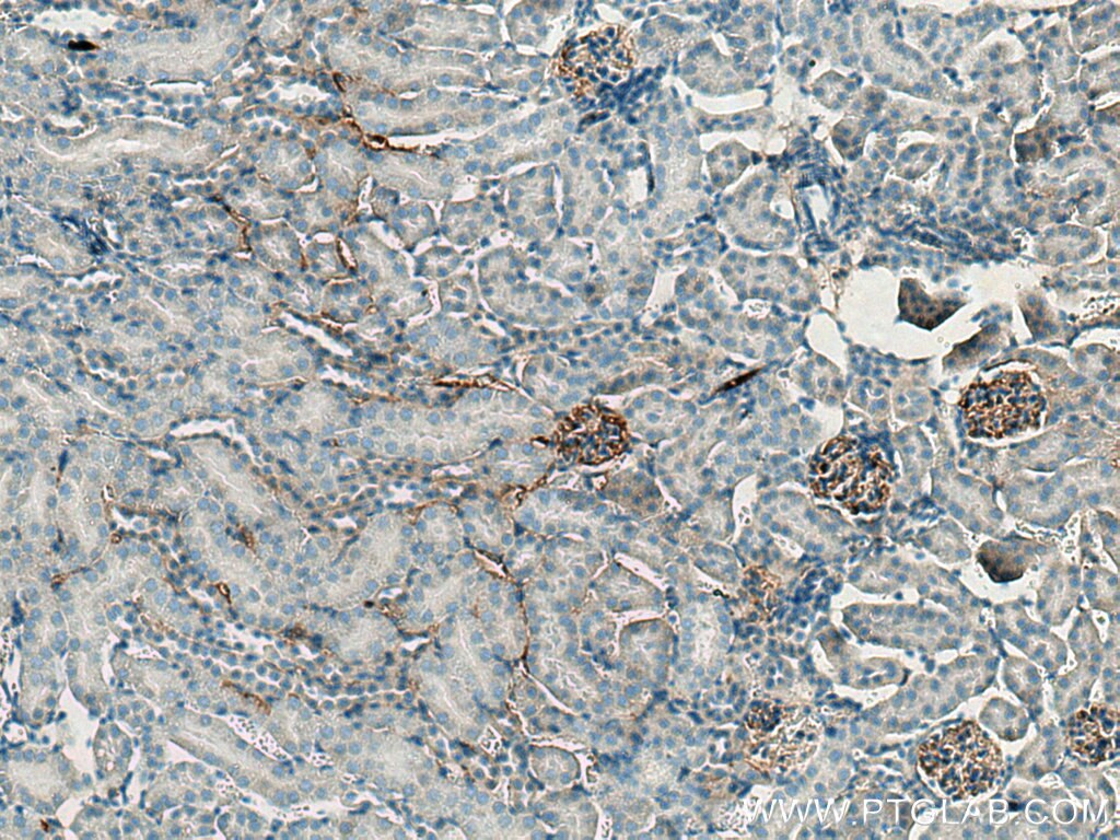 Immunohistochemistry (IHC) staining of mouse kidney tissue using ADAMTS13 Polyclonal antibody (20737-1-AP)