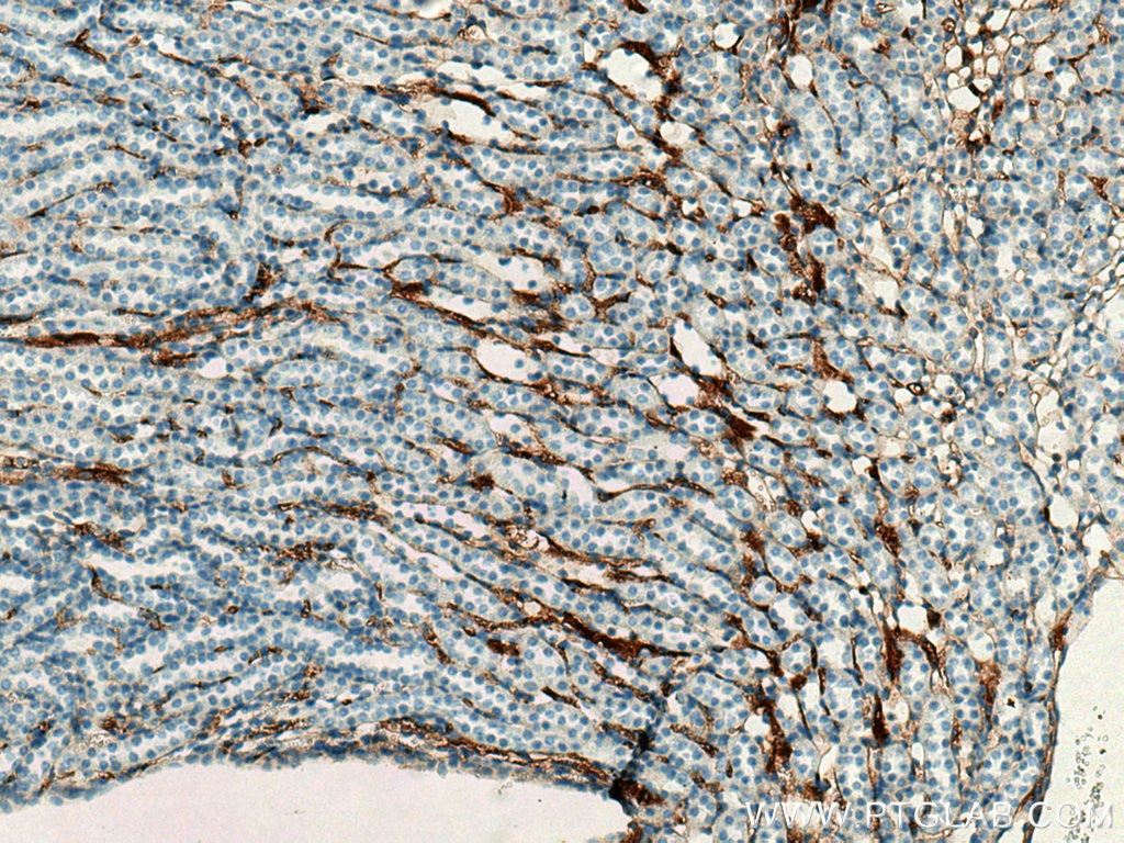 Immunohistochemistry (IHC) staining of mouse kidney tissue using ADAMTS13 Polyclonal antibody (20737-1-AP)