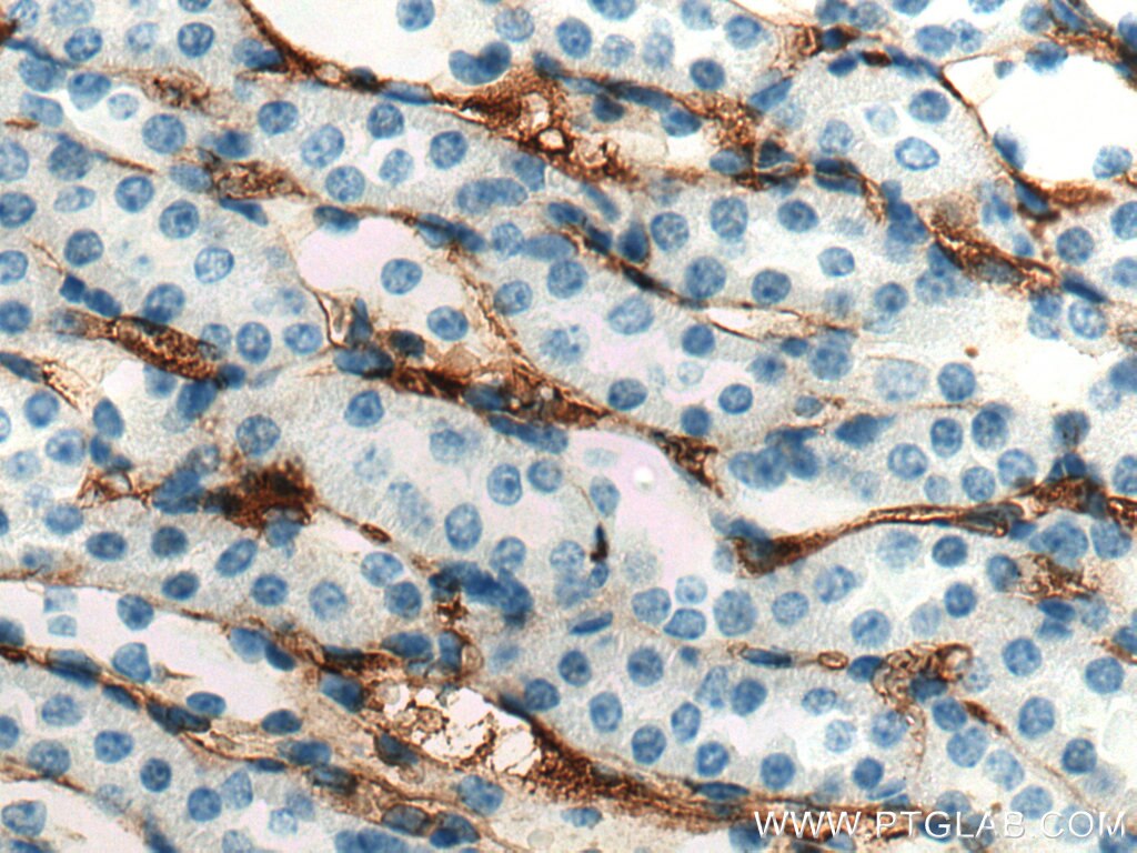 Immunohistochemistry (IHC) staining of mouse kidney tissue using ADAMTS13 Polyclonal antibody (20737-1-AP)