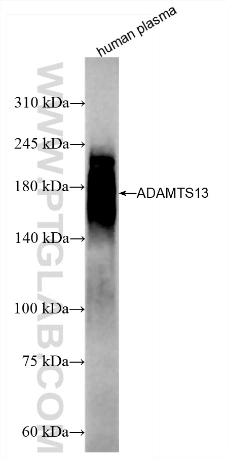 Western Blot (WB) analysis of human plasma using ADAMTS13 Recombinant antibody (85974-3-RR)