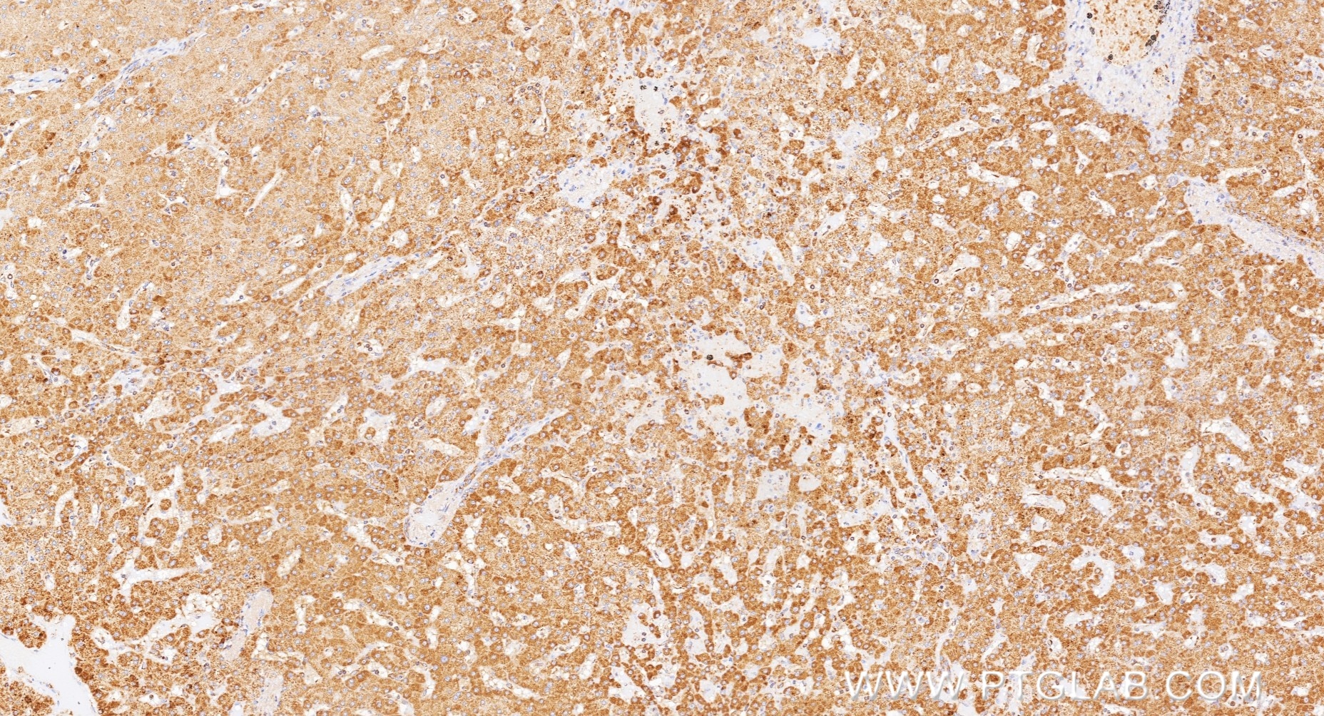 IHC staining of human liver using 98468-2-RR (same clone as 98468-2-PBS) Immunohistochemistry (IHC) staining of human liver tissue using Anti-Human ADAMTS13 Rabbit Recombinant Antibody (98468-2-RR)