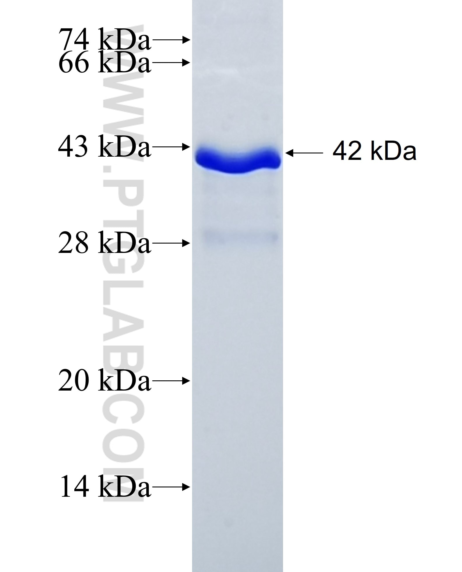 ADAMTS17 fusion protein Ag31999 SDS-PAGE