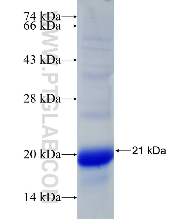 ADAMTS17 fusion protein Ag32013 SDS-PAGE