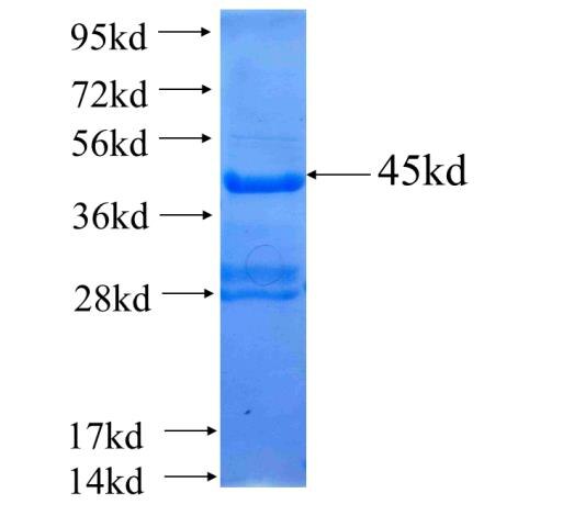 ADAMTS18 fusion protein Ag25219 SDS-PAGE