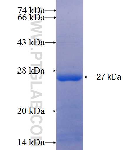 ADAMTS18 fusion protein Ag25236 SDS-PAGE