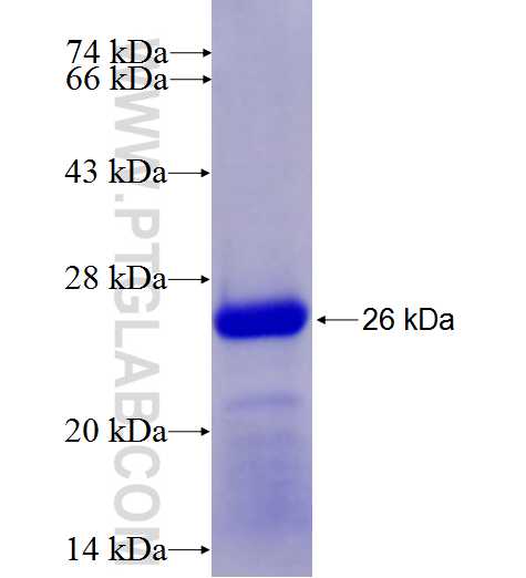 ADAMTS18 fusion protein Ag26970 SDS-PAGE