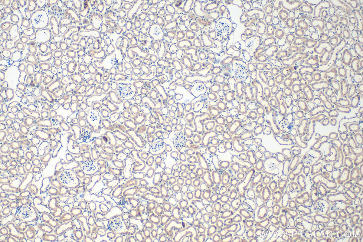 Immunohistochemical analysis of paraffin-embedded mouse kidney tissue slide using 32890-1-AP (ADAMTS19 antibody) at dilution of 1:400 (under 10x lens). Heat mediated antigen retrieval with Tris-EDTA buffer (pH 9.0). Immunohistochemistry (IHC) staining of mouse kidney tissue using ADAMTS19 Polyclonal antibody (32890-1-AP)