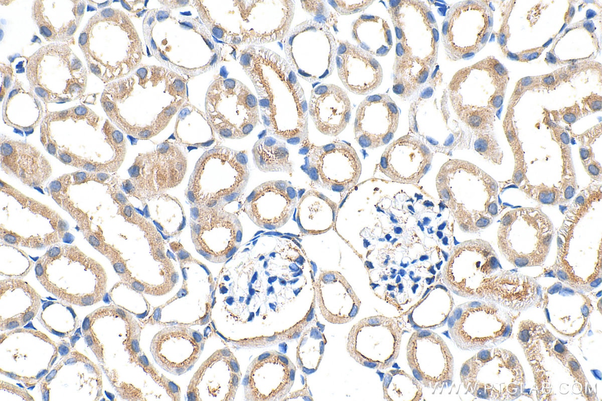 Immunohistochemical analysis of paraffin-embedded mouse kidney tissue slide using 32890-1-AP (ADAMTS19 antibody) at dilution of 1:400 (under 40x lens). Heat mediated antigen retrieval with Tris-EDTA buffer (pH 9.0). Immunohistochemistry (IHC) staining of mouse kidney tissue using ADAMTS19 Polyclonal antibody (32890-1-AP)