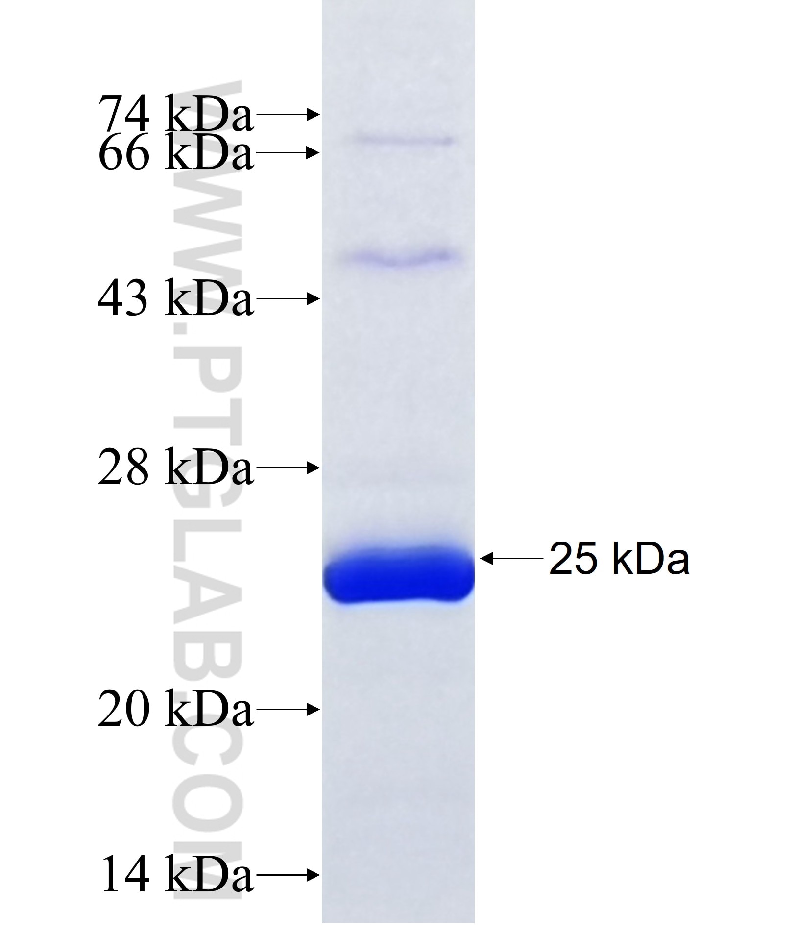 ADAMTS19 fusion protein Ag36959 SDS-PAGE ADAMTS19 fusion protein Ag36959 SDS-PAGE