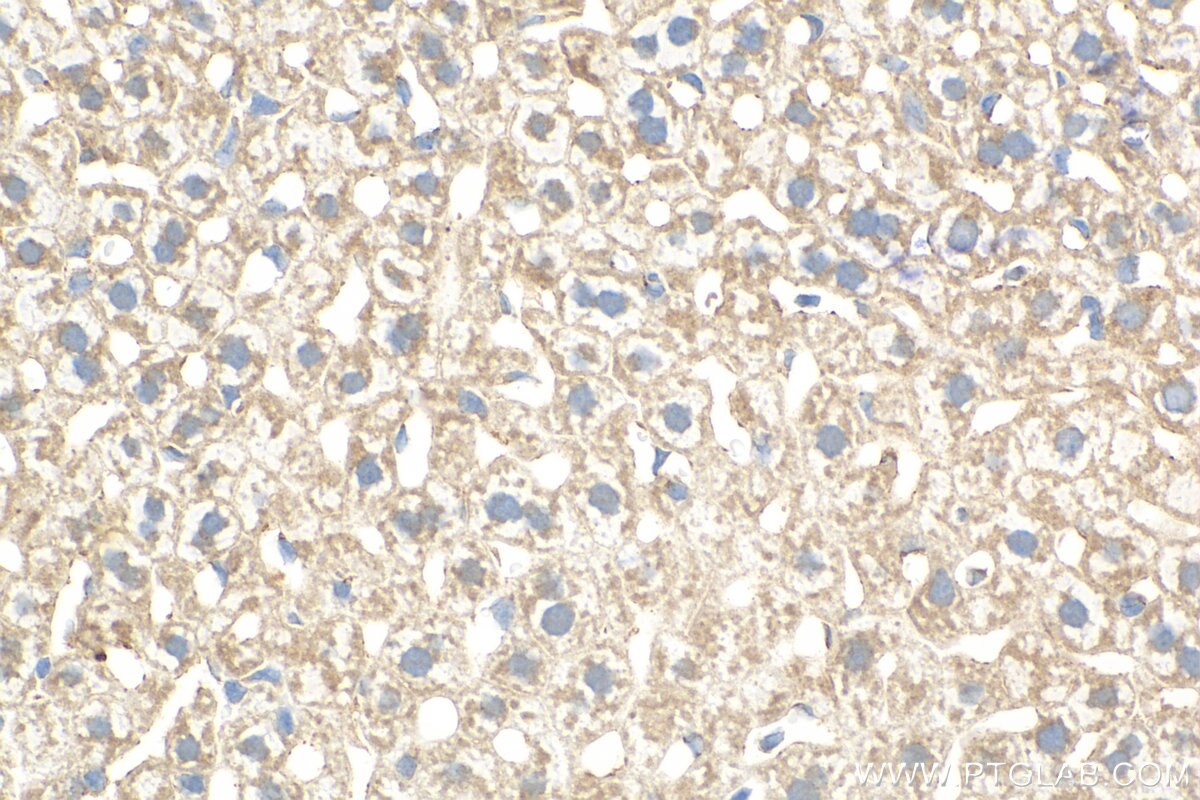 Immunohistochemistry (IHC) staining of mouse liver tissue using ADAMTS2 Polyclonal antibody (31032-1-AP)