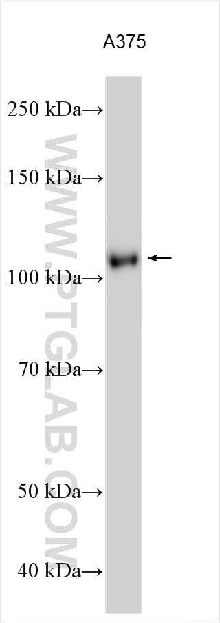 Western Blot (WB) analysis of various lysates using ADAMTS2 Polyclonal antibody (31032-1-AP)