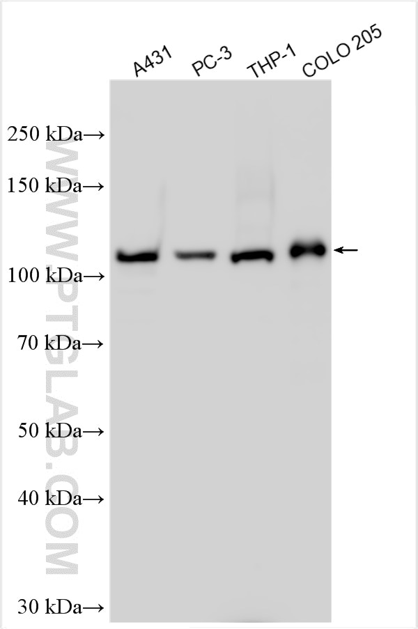 Western Blot (WB) analysis of various lysates using ADAMTS2 Polyclonal antibody (31032-1-AP)