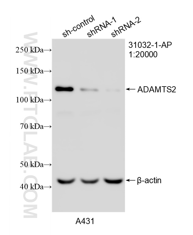 Western Blot (WB) analysis of A431 cells using ADAMTS2 Polyclonal antibody (31032-1-AP)