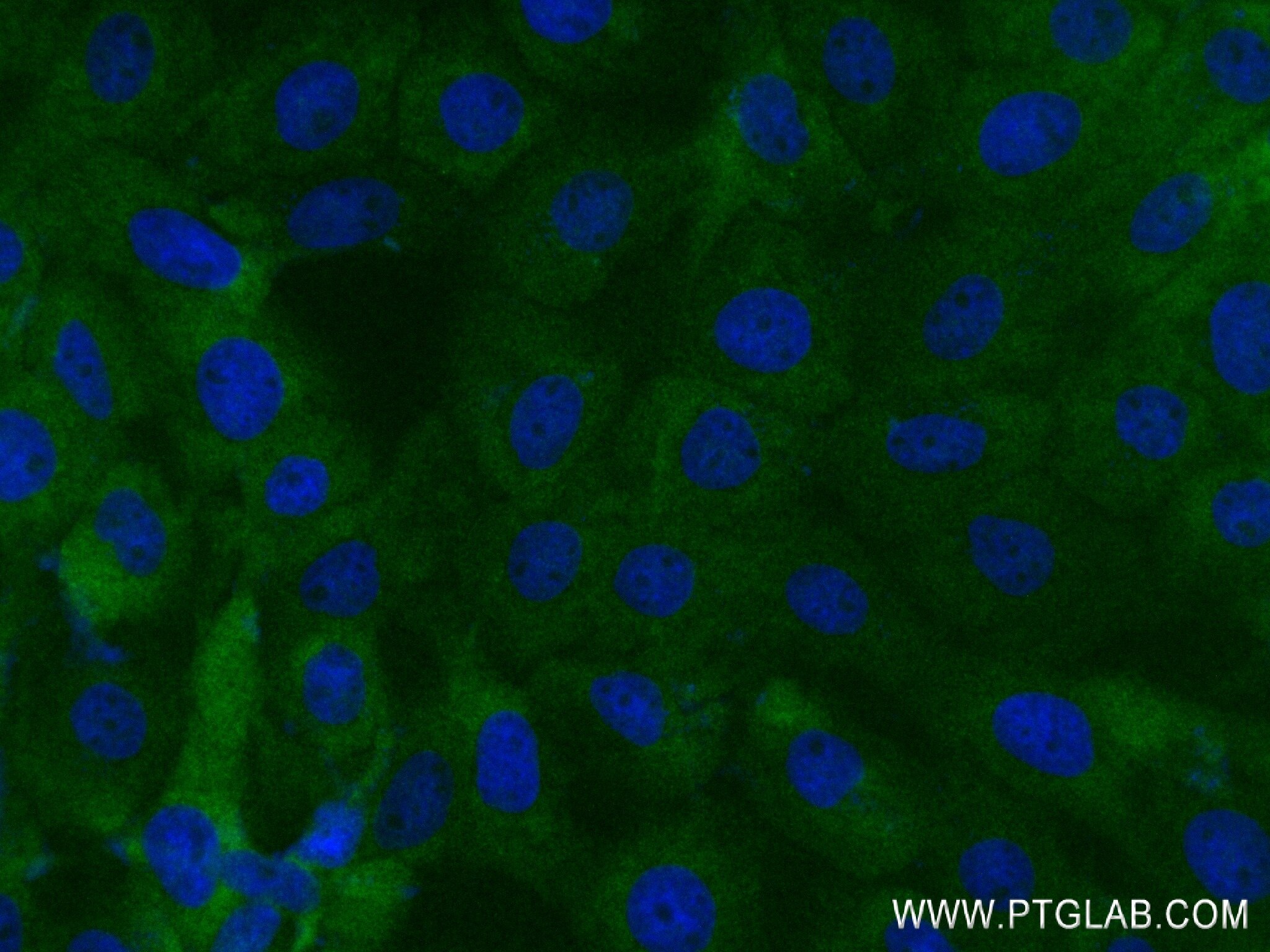 Immunofluorescence (IF) / fluorescent staining of A431 cells using ADAMTS2 Recombinant antibody (84476-6-RR)