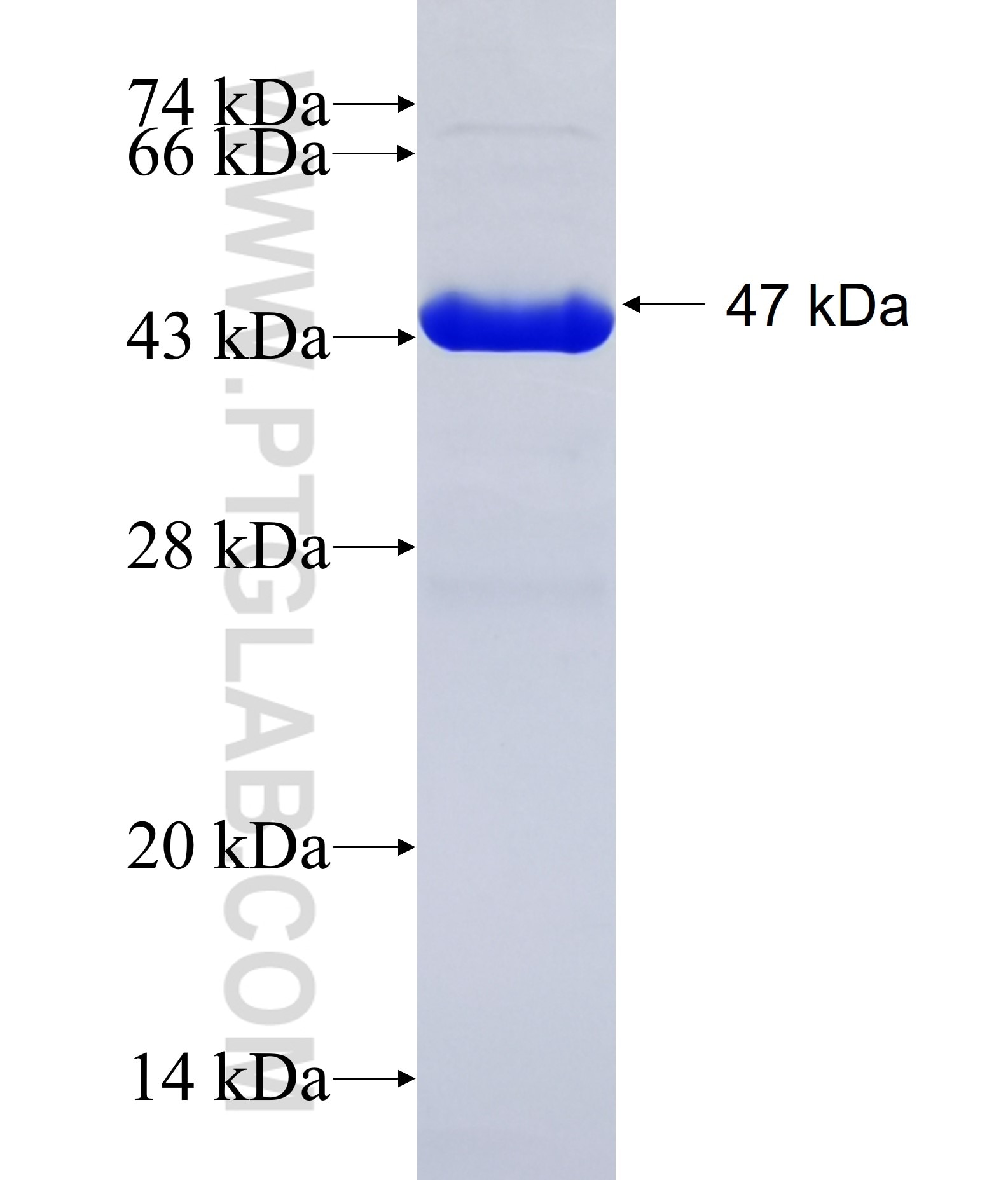 ADAMTS2 fusion protein Ag34957 SDS-PAGE