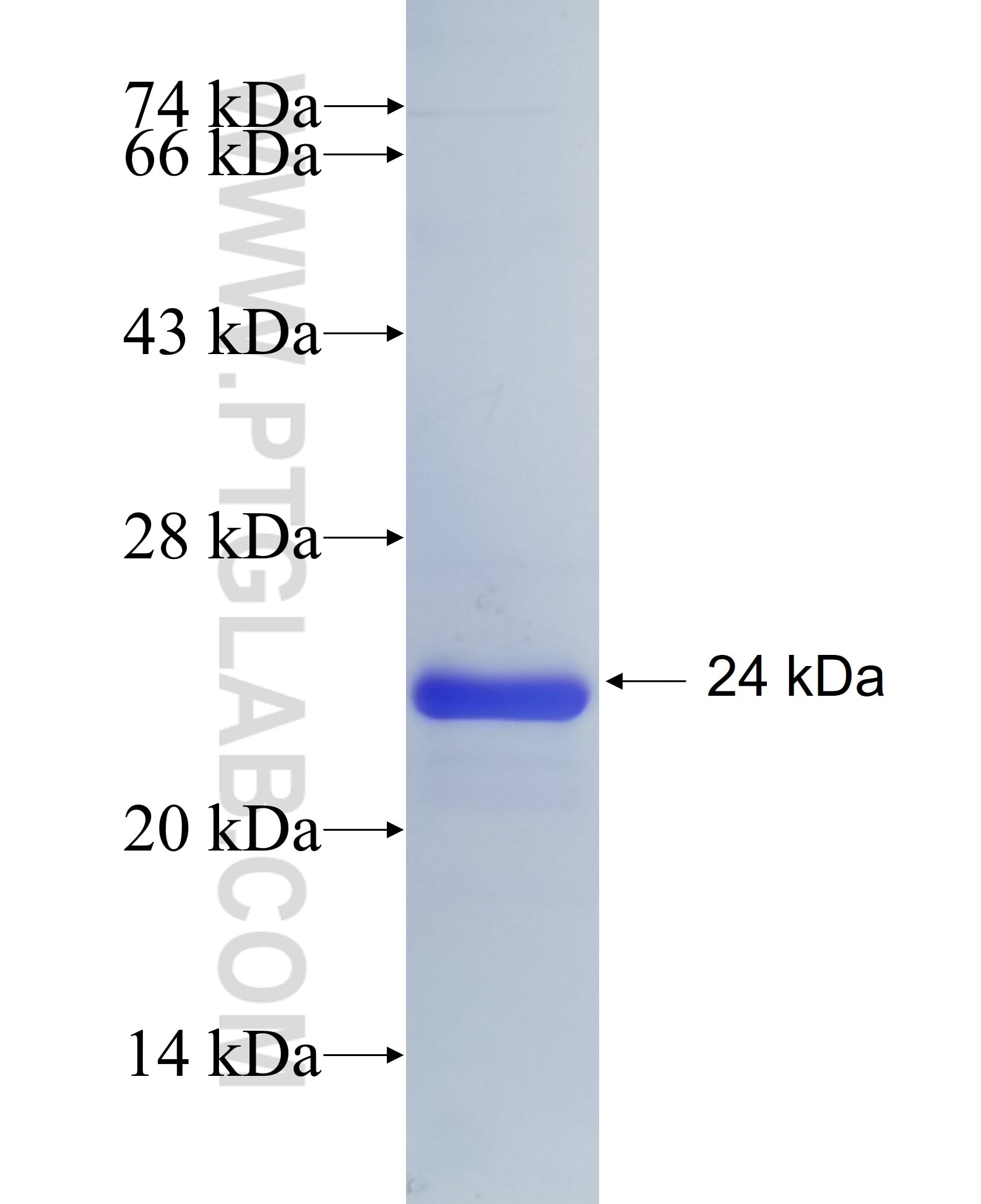 ADAMTS2 fusion protein Ag34984 SDS-PAGE