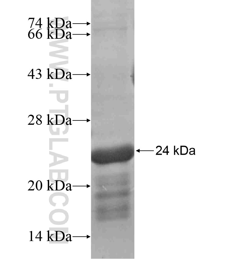 ADAMTS3 fusion protein Ag17694 SDS-PAGE