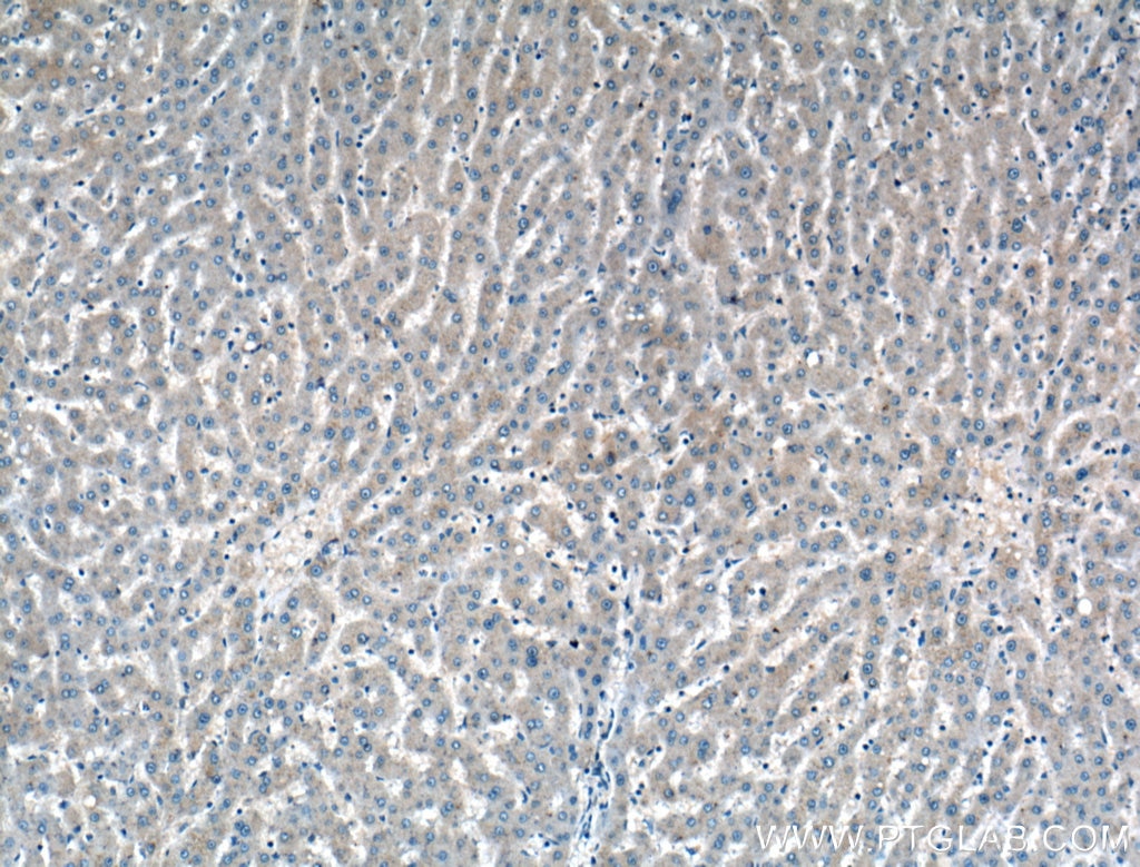 IHC staining of human liver using 11865-1-AP