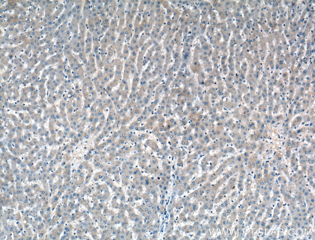 Immunohistochemistry (IHC) staining of human liver tissue using ADAMTS4 Polyclonal antibody (11865-1-AP)