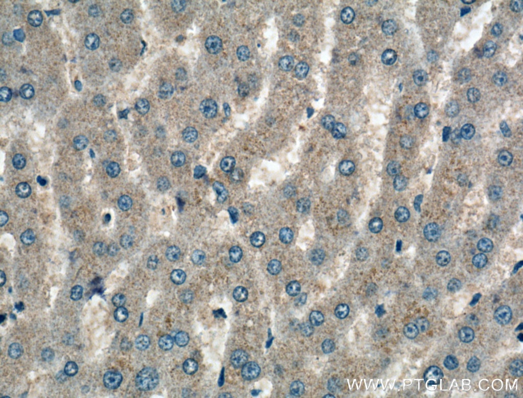 Immunohistochemistry (IHC) staining of human liver tissue using ADAMTS4 Polyclonal antibody (11865-1-AP)