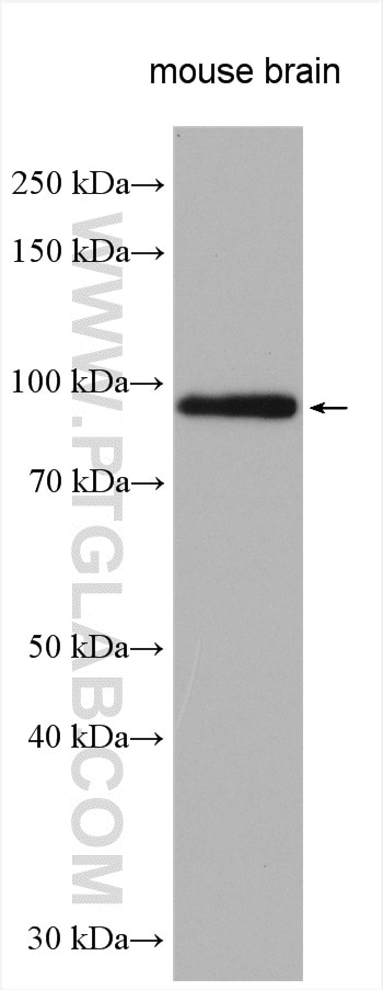 Western Blot (WB) analysis of various lysates using ADAMTS4 Polyclonal antibody (11865-1-AP)