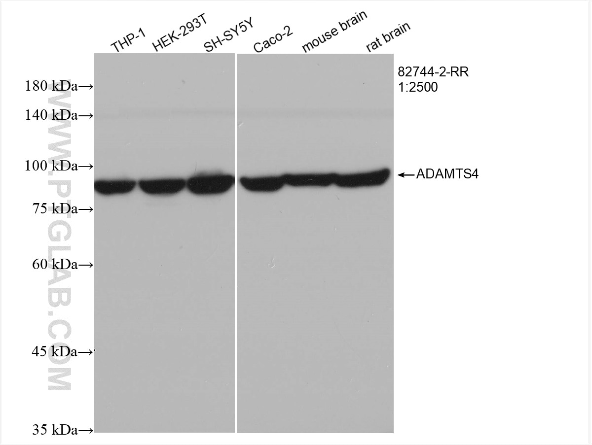 Western Blot (WB) analysis of various lysates using ADAMTS4 Recombinant antibody (82744-2-RR)