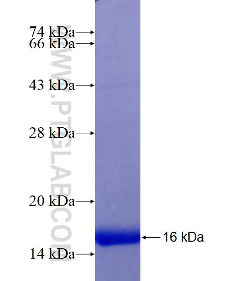 ADAMTS4 fusion protein Ag25592 SDS-PAGE