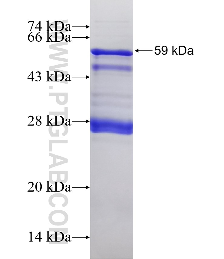 ADAMTS4 fusion protein Ag2443 SDS-PAGE