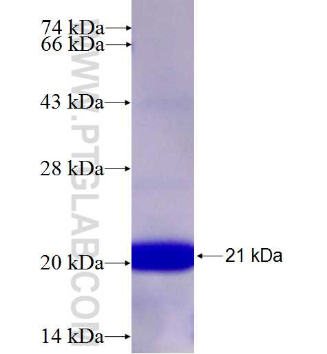 ADAMTS5 fusion protein Ag26730 SDS-PAGE