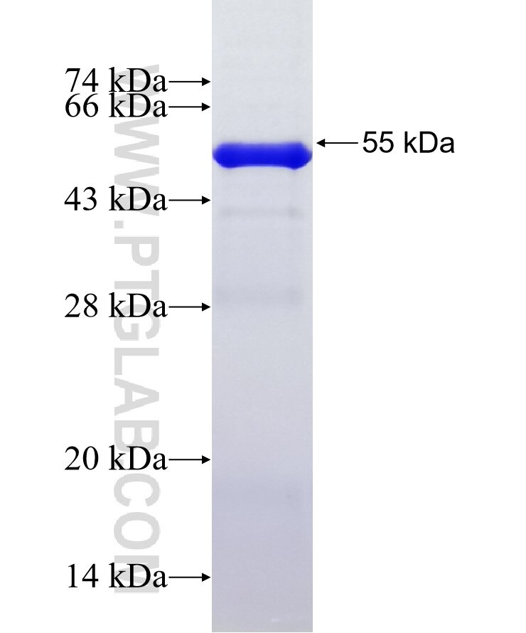 ADAMTS6 fusion protein Ag29535 SDS-PAGE