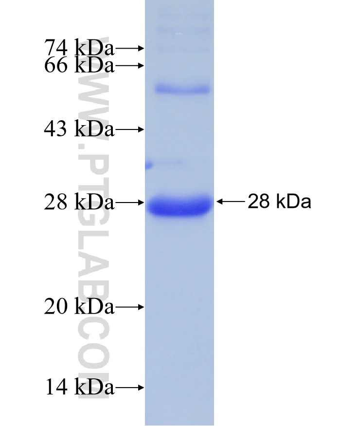 ADAMTS6 fusion protein Ag29556 SDS-PAGE ADAMTS6 fusion protein Ag29556 SDS-PAGE