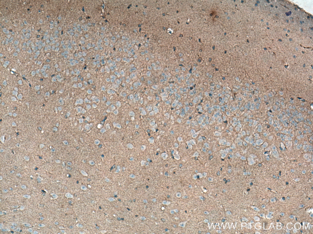 Immunohistochemistry (IHC) staining of mouse brain tissue using ADAMTS7 Polyclonal antibody (26836-1-AP)