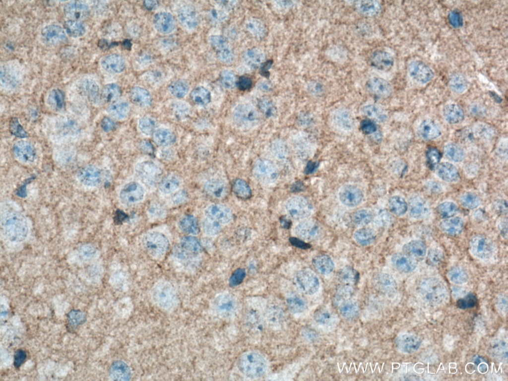 Immunohistochemistry (IHC) staining of mouse brain tissue using ADAMTS7 Polyclonal antibody (26836-1-AP)