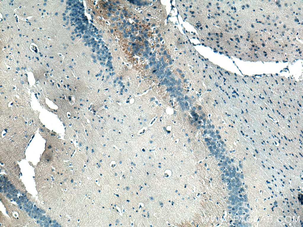 IHC staining of mouse brain using 26836-1-AP