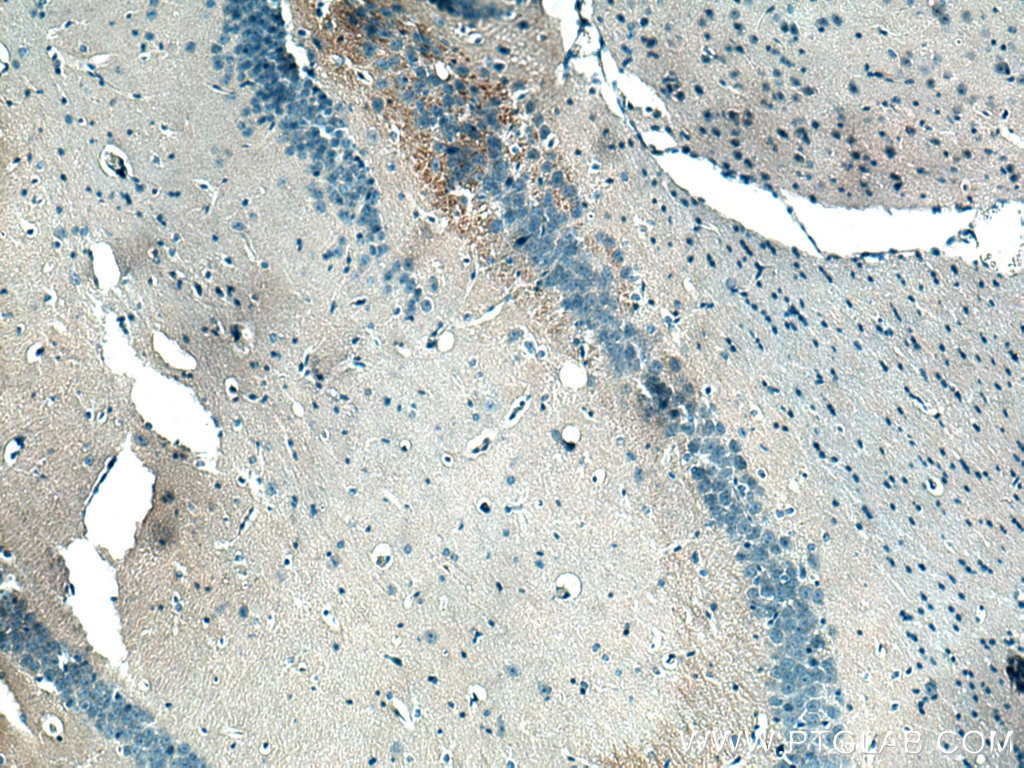 Immunohistochemistry (IHC) staining of mouse brain tissue using ADAMTS7 Polyclonal antibody (26836-1-AP)