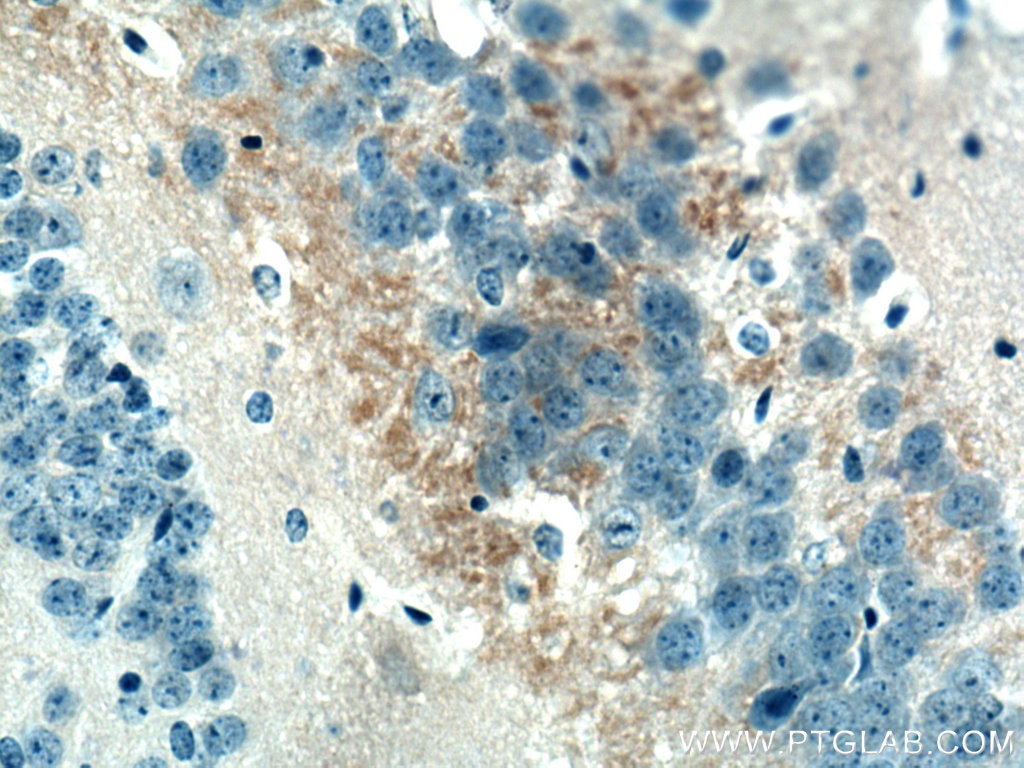 Immunohistochemistry (IHC) staining of mouse brain tissue using ADAMTS7 Polyclonal antibody (26836-1-AP)