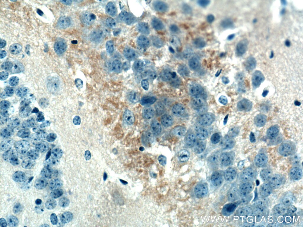 IHC staining of mouse brain using 26836-1-AP