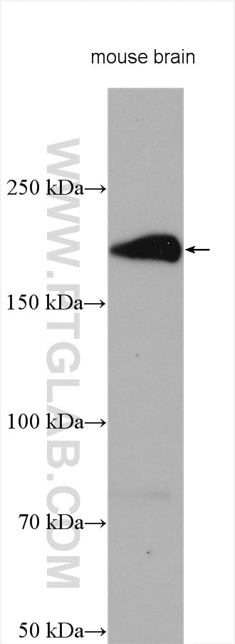 Western Blot (WB) analysis of various lysates using ADAMTS7 Polyclonal antibody (26836-1-AP)