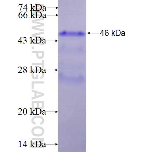 ADAMTS7 fusion protein Ag25218 SDS-PAGE
