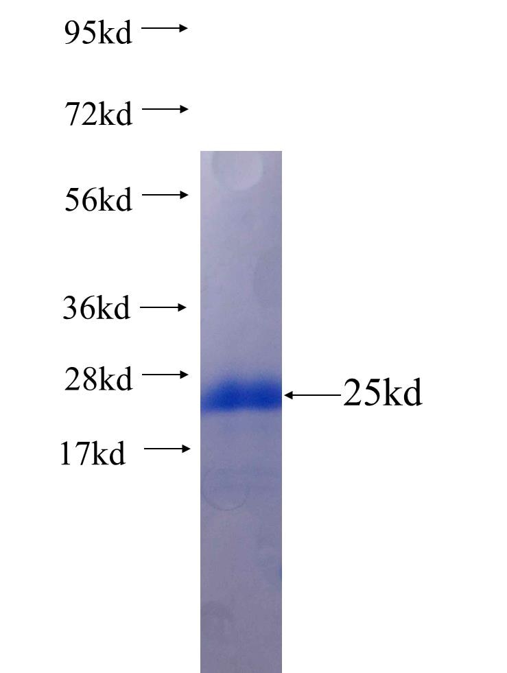 ADAMTS7 fusion protein Ag25235 SDS-PAGE