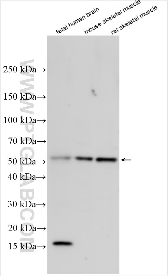 Western Blot (WB) analysis of various lysates using ADAMTSL1 Polyclonal antibody (13337-1-AP)