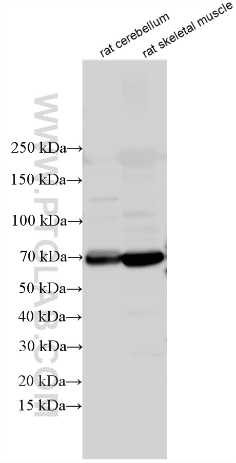 Western Blot (WB) analysis of various lysates using ADAMTSL1 Polyclonal antibody (13337-1-AP)