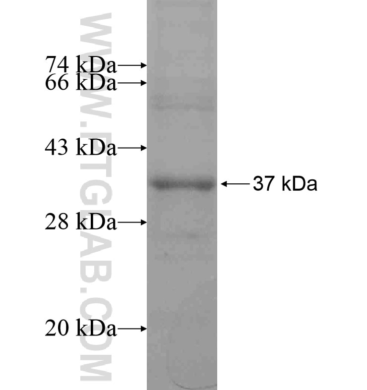 ADAMTSL1 fusion protein Ag16564 SDS-PAGE