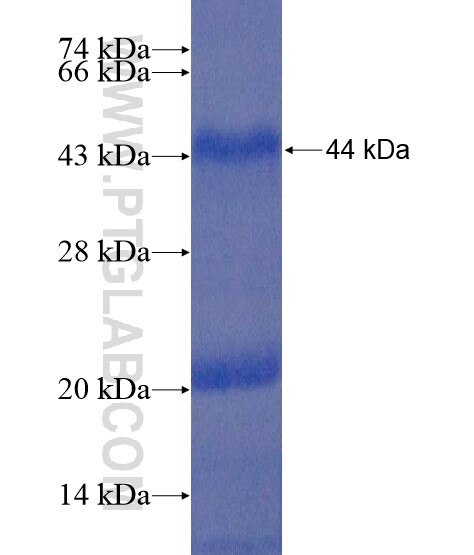 ADAMTSL1 fusion protein Ag20369 SDS-PAGE