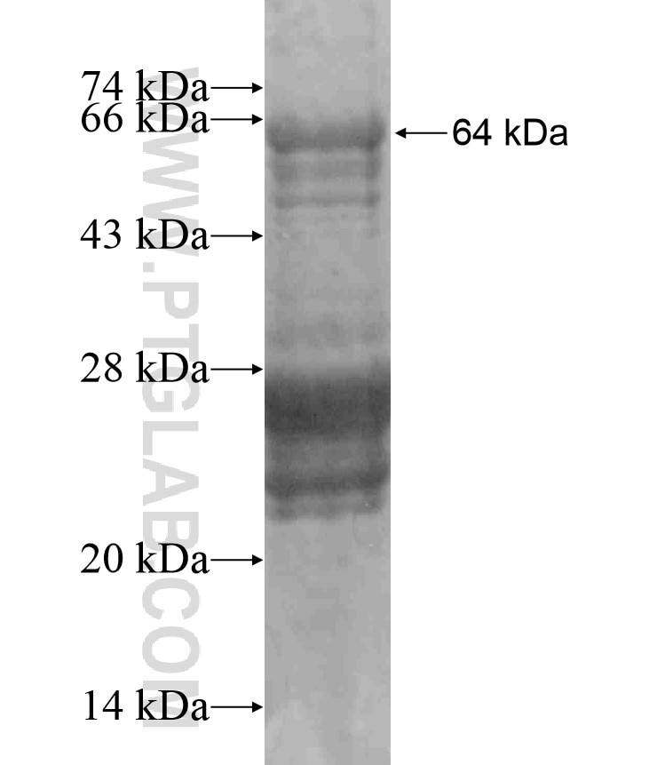 ADAMTSL2 fusion protein Ag17545 SDS-PAGE