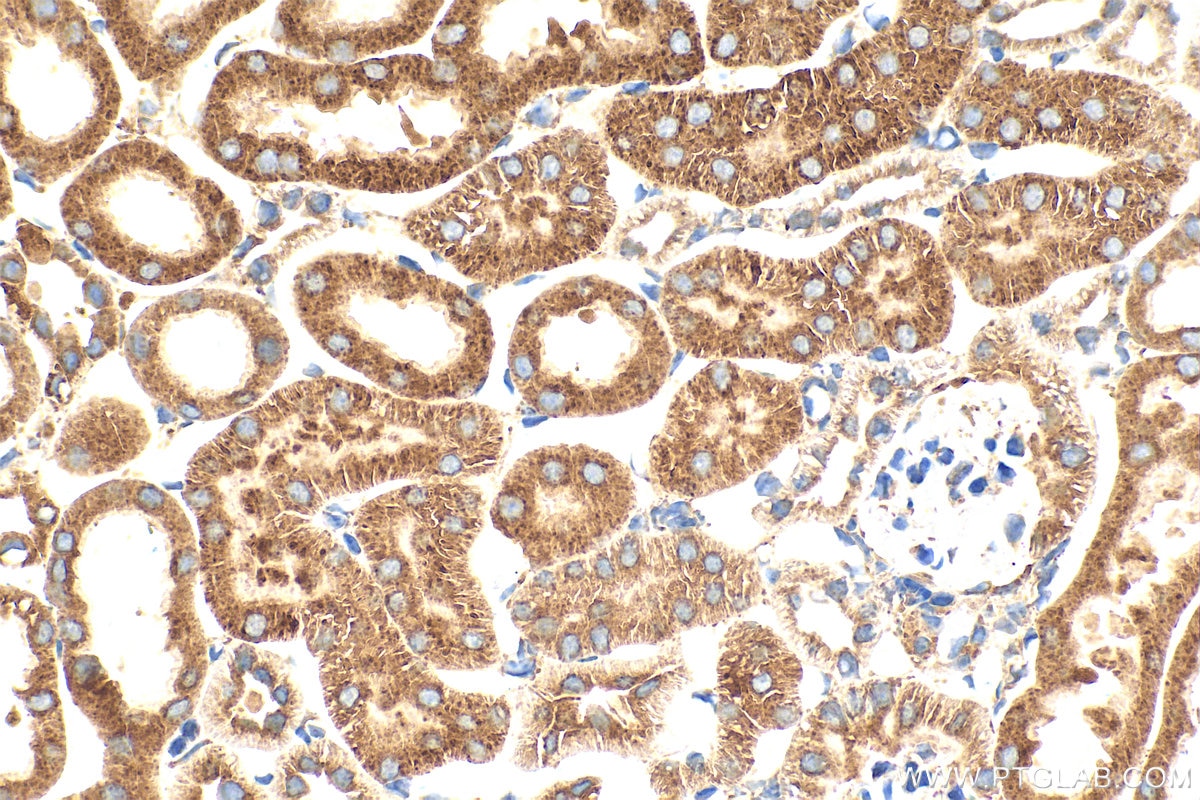 IHC staining of mouse kidney using 26653-1-AP (same clone as 26653-1-PBS) Immunohistochemistry (IHC) staining of mouse kidney tissue using ADAMTSL3 Polyclonal antibody (26653-1-AP)