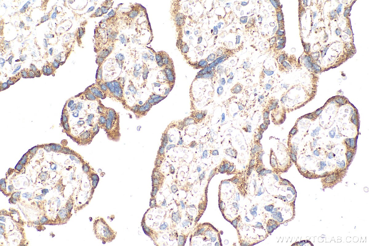 IHC staining of human placenta using 26653-1-AP (same clone as 26653-1-PBS) Immunohistochemistry (IHC) staining of human placenta tissue using ADAMTSL3 Polyclonal antibody (26653-1-AP)