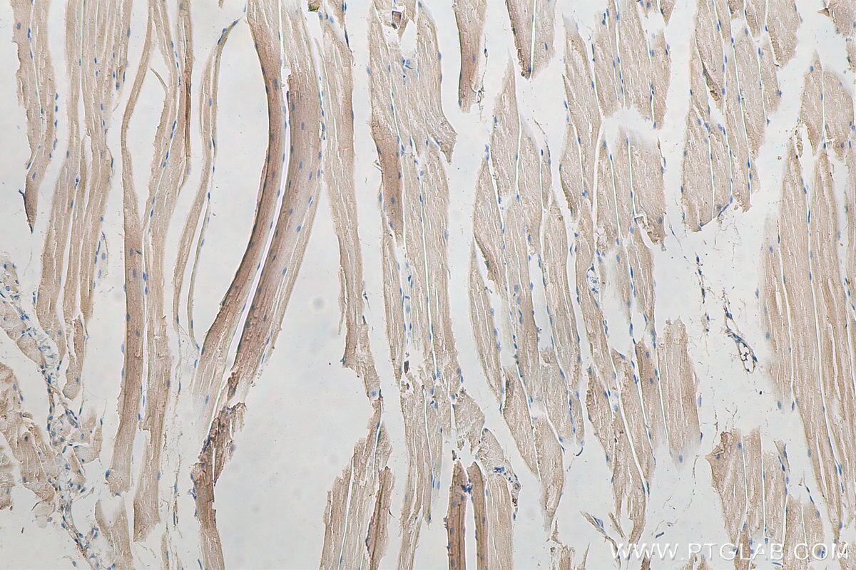 Immunohistochemistry (IHC) staining of mouse skeletal muscle tissue using ADAMTSL4 Polyclonal antibody (15304-1-AP)