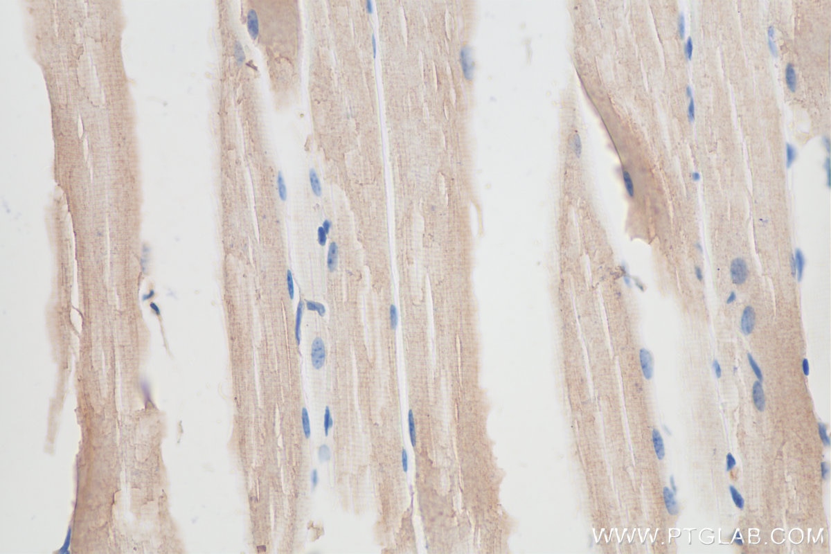 Immunohistochemistry (IHC) staining of mouse skeletal muscle tissue using ADAMTSL4 Polyclonal antibody (15304-1-AP)