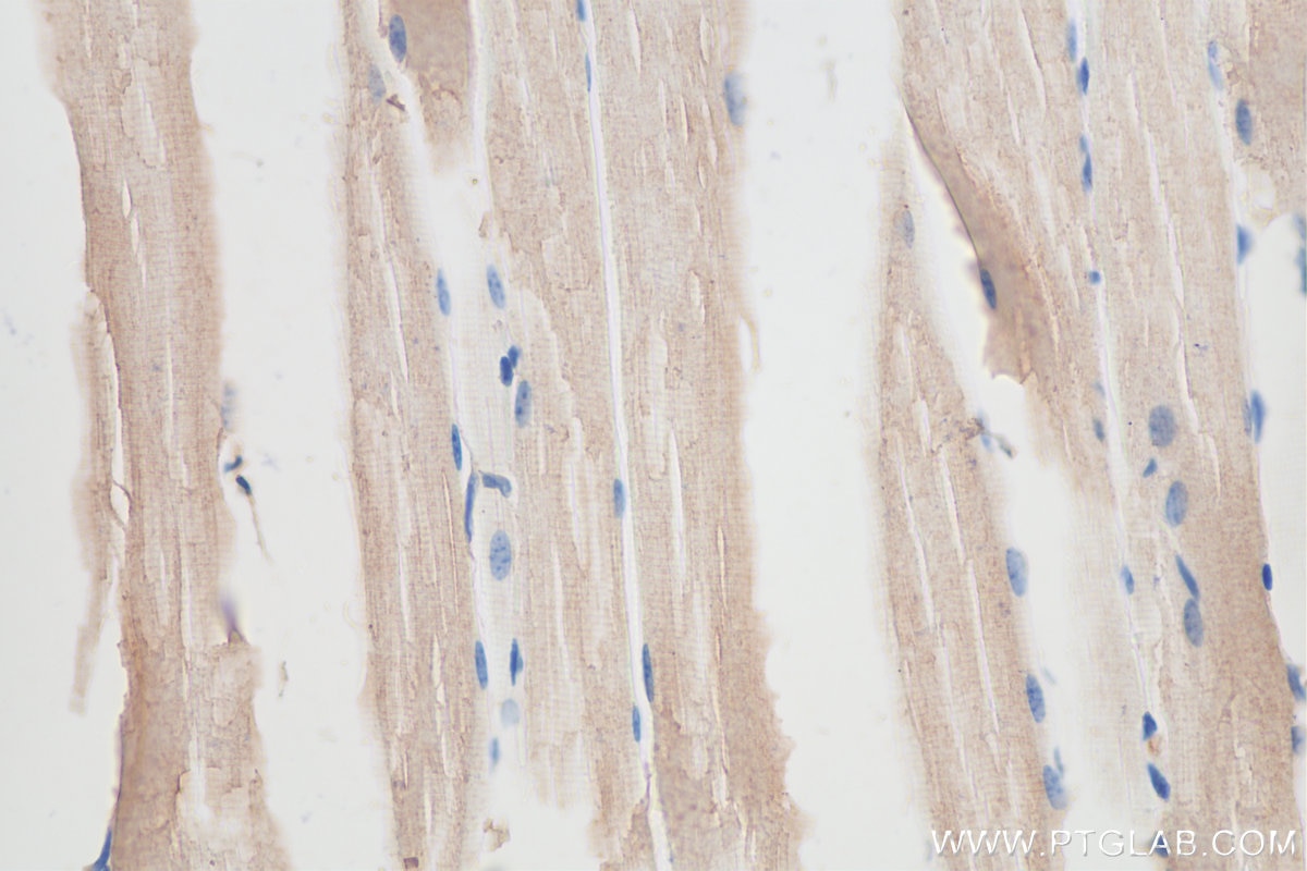 IHC staining of mouse skeletal muscle using 15304-1-AP